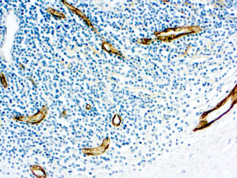 Factor VIII R Antigen