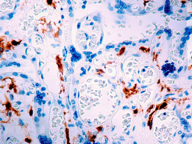 Factor XIIIa