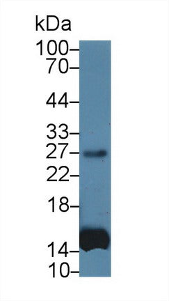 Monoclonal Antibody to Interleukin 6 (IL6)