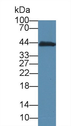 Monoclonal Antibody to Creatine Kinase, Muscle (CKM)
