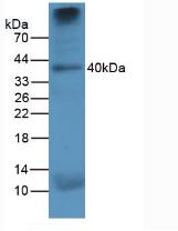 Monoclonal Antibody to Cathepsin K (CTSK)