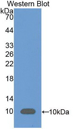 Monoclonal Antibody to Complement Component 5a (C5a)