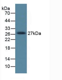 Monoclonal Antibody to Dickkopf Related Protein 1 (DKK1)