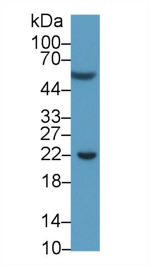 Monoclonal Antibody to Programmed Cell Death Protein 1 Ligand 1 (PDL1)