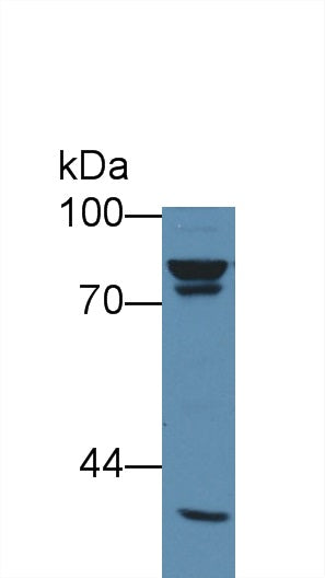 Monoclonal Antibody to Vimentin (VIM)