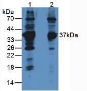 Monoclonal Antibody to Lactate Dehydrogenase B (LDHB)