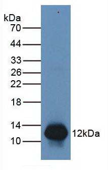 Monoclonal Antibody to S100 Calcium Binding Protein A8 (S100A8)