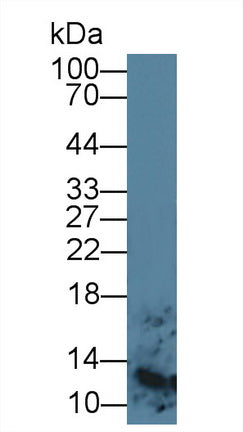 Monoclonal Antibody to S100 Calcium Binding Protein A8 (S100A8)