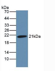 Monoclonal Antibody to Hemojuvelin (HJV)
