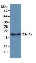 Monoclonal Antibody to Apolipoprotein L2 (APOL2)