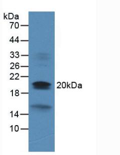 Monoclonal Antibody to Dual Specificity Phosphatase 3 (DUSP3)