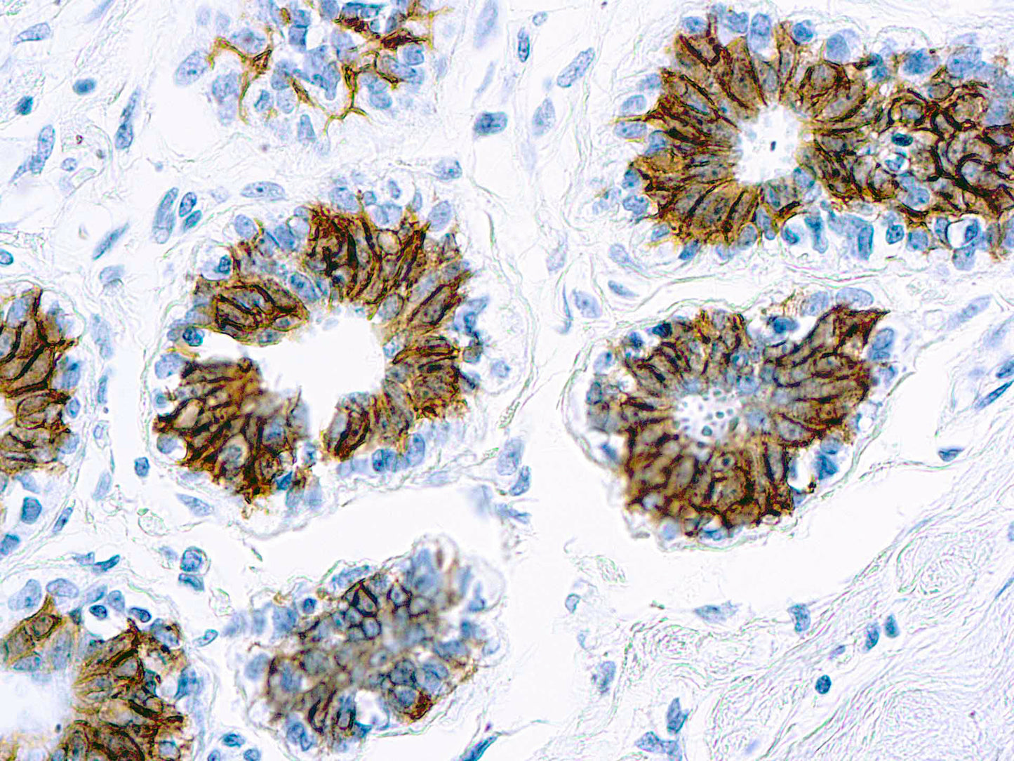 Epithelial Antigen