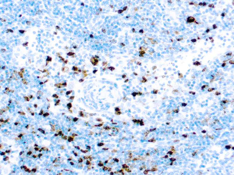Myeloperoxidase