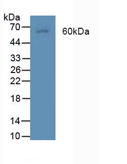 Polyclonal Antibody to Bone Morphogenetic Protein Receptor 2 (BMPR2)