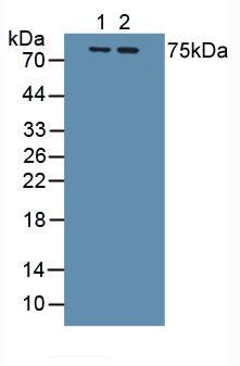 Polyclonal Antibody to Interleukin 1 Receptor Type I (IL1R1)