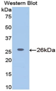 Polyclonal Antibody to Meningioma Expressed Antigen 5 (MGEA5)