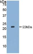 Polyclonal Antibody to Matrix Metalloproteinase 13 (MMP13)