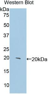 Polyclonal Antibody to Centromere Protein E (CENPE)