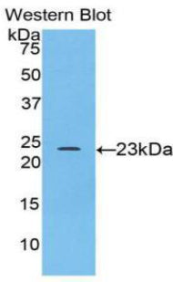Polyclonal Antibody to Alpha-Fodrin (SPTAN1)
