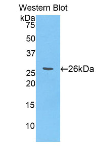 Polyclonal Antibody to Alpha-Fodrin (SPTAN1)