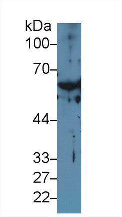 Polyclonal Antibody to Cytokeratin 1 (CK1)