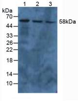 Polyclonal Antibody to Pyruvate kinase isozymes M2 (PKM2)