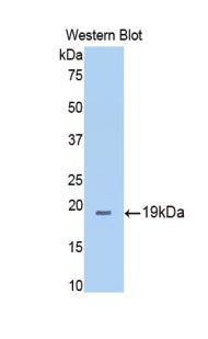 Polyclonal Antibody to Thrombospondin 1 (THBS1)