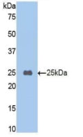 Polyclonal Antibody to Carboxypeptidase B2 (CPB2)