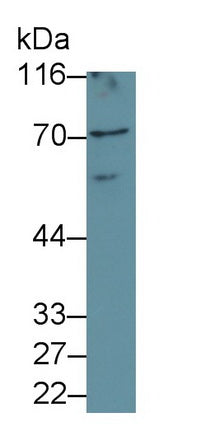 Polyclonal Antibody to V-Rel Reticuloendotheliosis Viral Oncogene Homolog A (RELA)