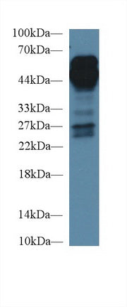 Polyclonal Antibody to Receptor For Advanced Glycation Endproducts (RAGE)