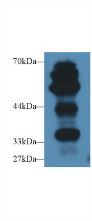 Polyclonal Antibody to Receptor For Advanced Glycation Endproducts (RAGE)