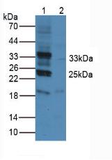 Polyclonal Antibody to Programmed Cell Death Protein 1 Ligand 1 (PDL1)
