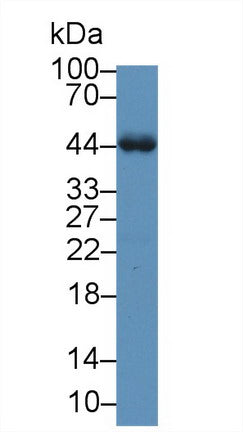 Polyclonal Antibody to Alpha-1-Acid Glycoprotein (a1AGP)
