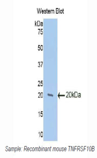 Polyclonal Antibody to Death receptor 5 (DR5)