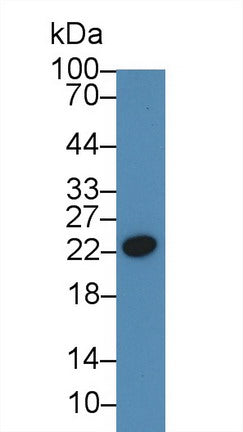 Polyclonal Antibody to C Reactive Protein (CRP)