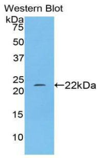 Polyclonal Antibody to Nitric Oxide Synthase 2, Inducible (NOS2)
