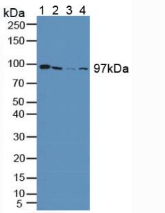 Polyclonal Antibody to Glycogen Phosphorylase, Liver (PYGL)