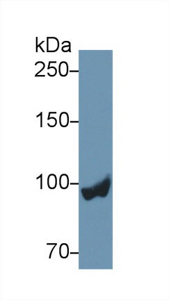 Polyclonal Antibody to Glycogen Phosphorylase, Liver (PYGL)