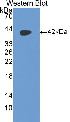 Polyclonal Antibody to Parathyroid Hormone (PTH)