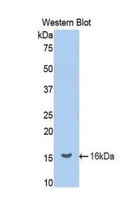 Polyclonal Antibody to Renin (REN)