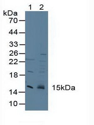 Polyclonal Antibody to Cystatin C (Cys-C)
