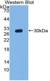 Polyclonal Antibody to Acid Phosphatase 5, Tartrate Resistant (ACP5)