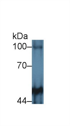 Polyclonal Antibody to Protein Tyrosine Phosphatase Receptor Type M (PTPRM)