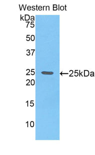 Polyclonal Antibody to Glypican 4 (GPC4)