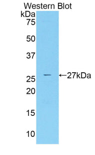 Polyclonal Antibody to Runt Related Transcription Factor 2 (RUNX2)