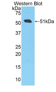 Polyclonal Antibody to Amyloid Precursor Protein (APP)