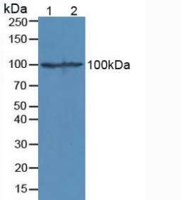 Polyclonal Antibody to Beta Catenin (β-catenin)