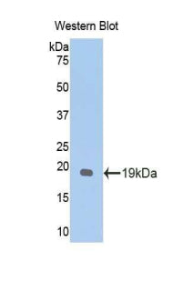 Polyclonal Antibody to Glypican 1 (GPC1)