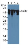 Polyclonal Antibody to Vimentin (VIM)