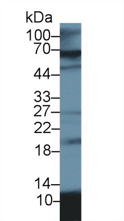 Polyclonal Antibody to S100 Calcium Binding Protein A12 (S100A12)